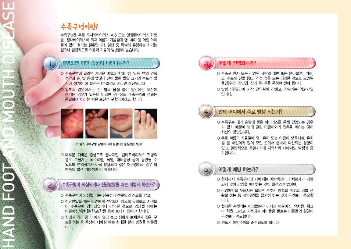 수족구병 안내문 이미지(1)
